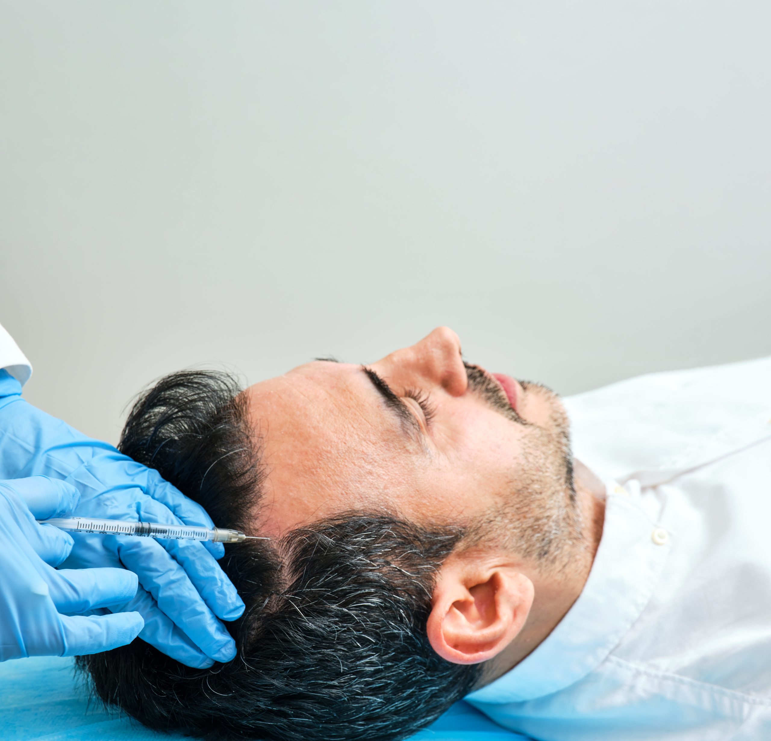 Hair Transplant for Scar Coverage: Using Hair Restoration Techniques to Conceal Scarring