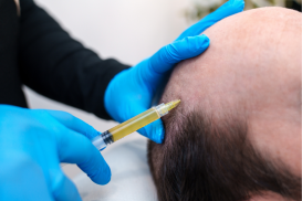 Choosing a Clinic for Hair Transplantation Abroad: What to Look For
