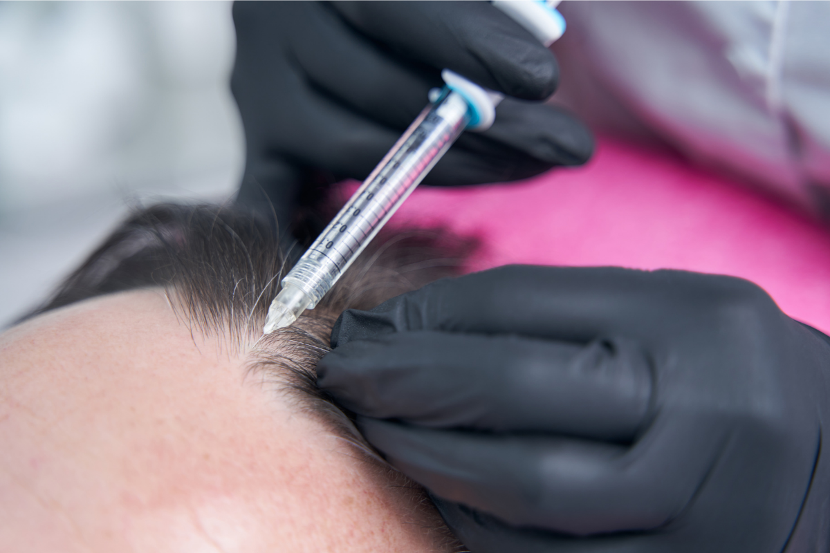 Choosing the Right Hair Transplant Method: FUE vs. FUT – What’s Best for You?