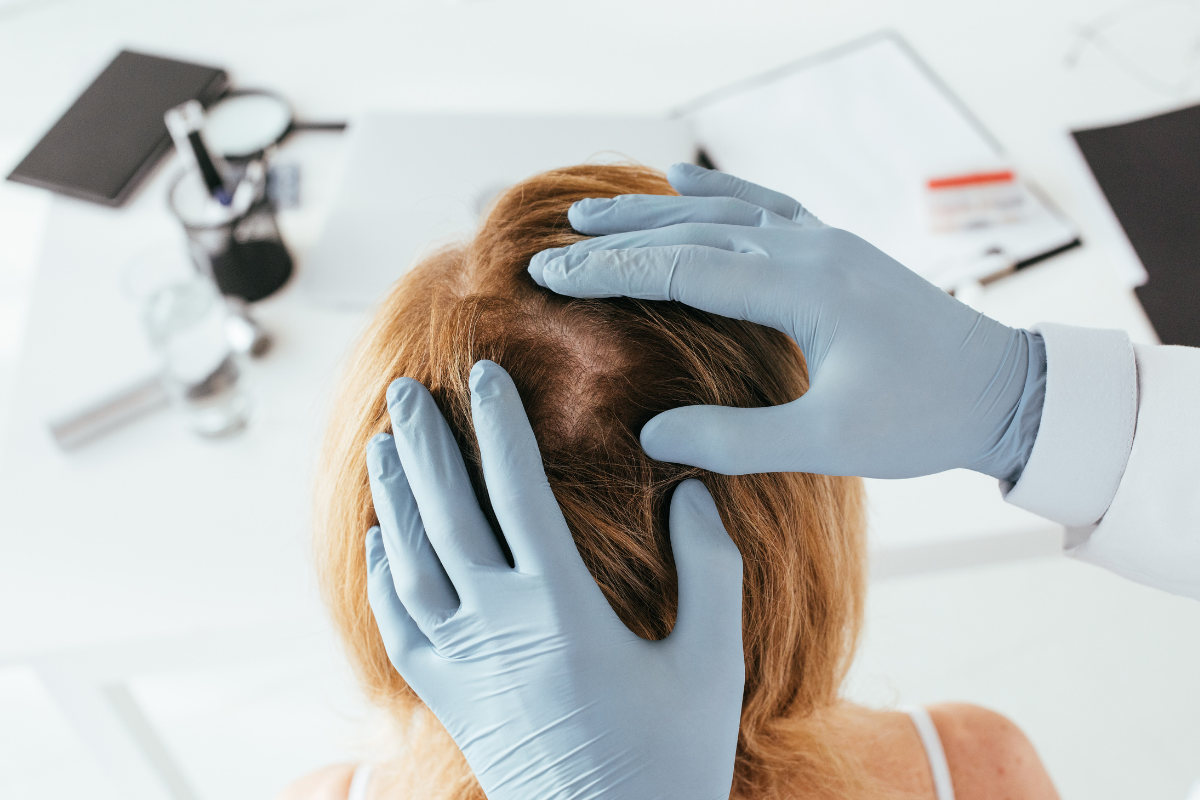 What to Expect in the First Few Weeks After a Hair Transplant: Recovery Timeline and Tips